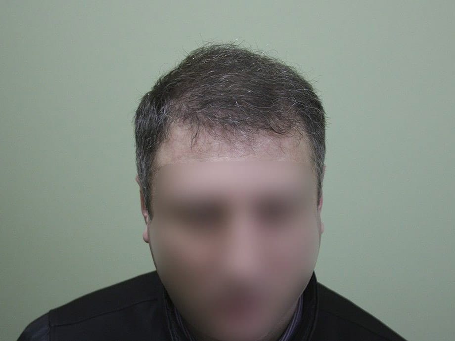 После