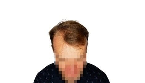 До