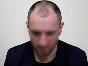 До