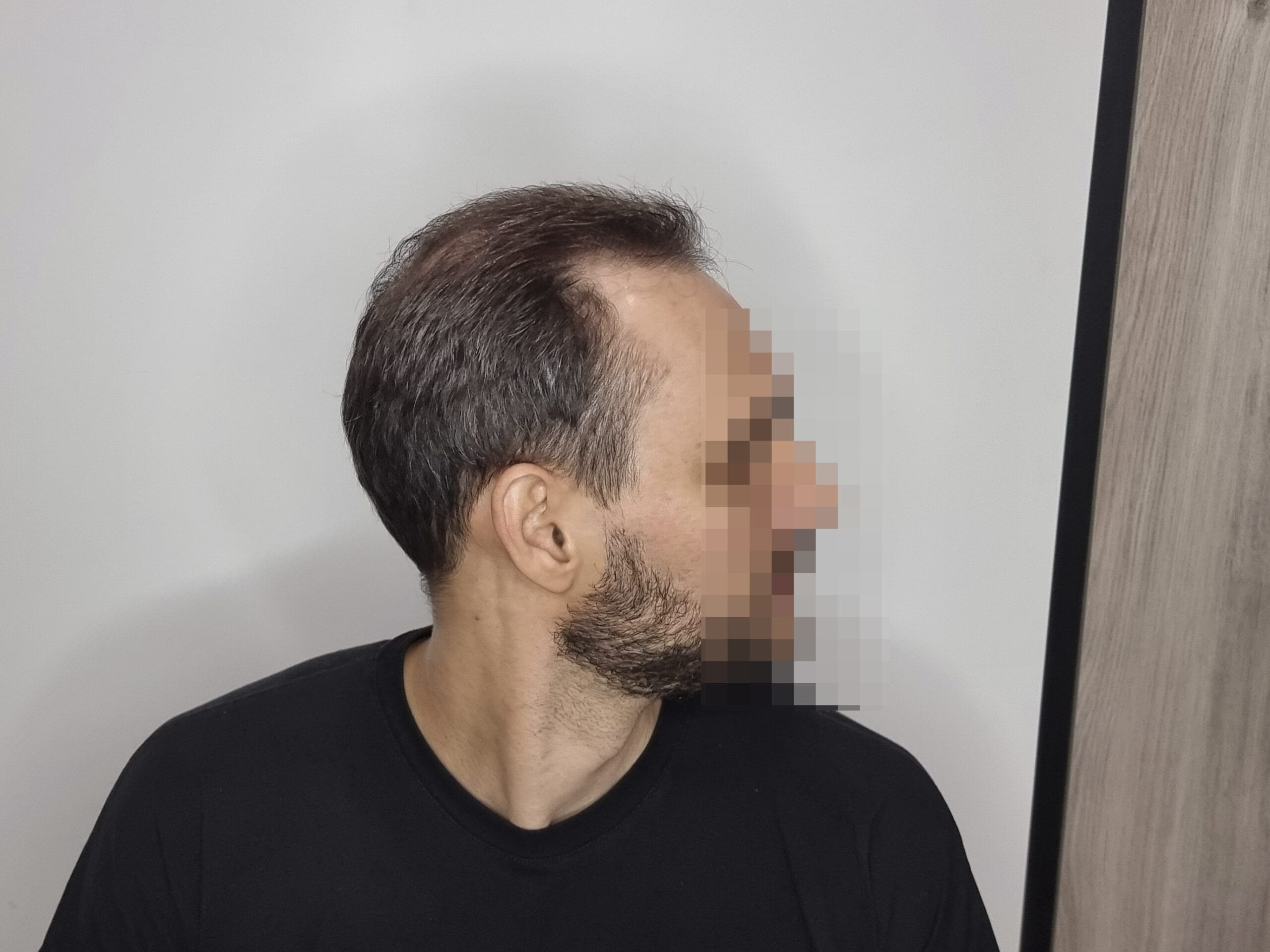 До