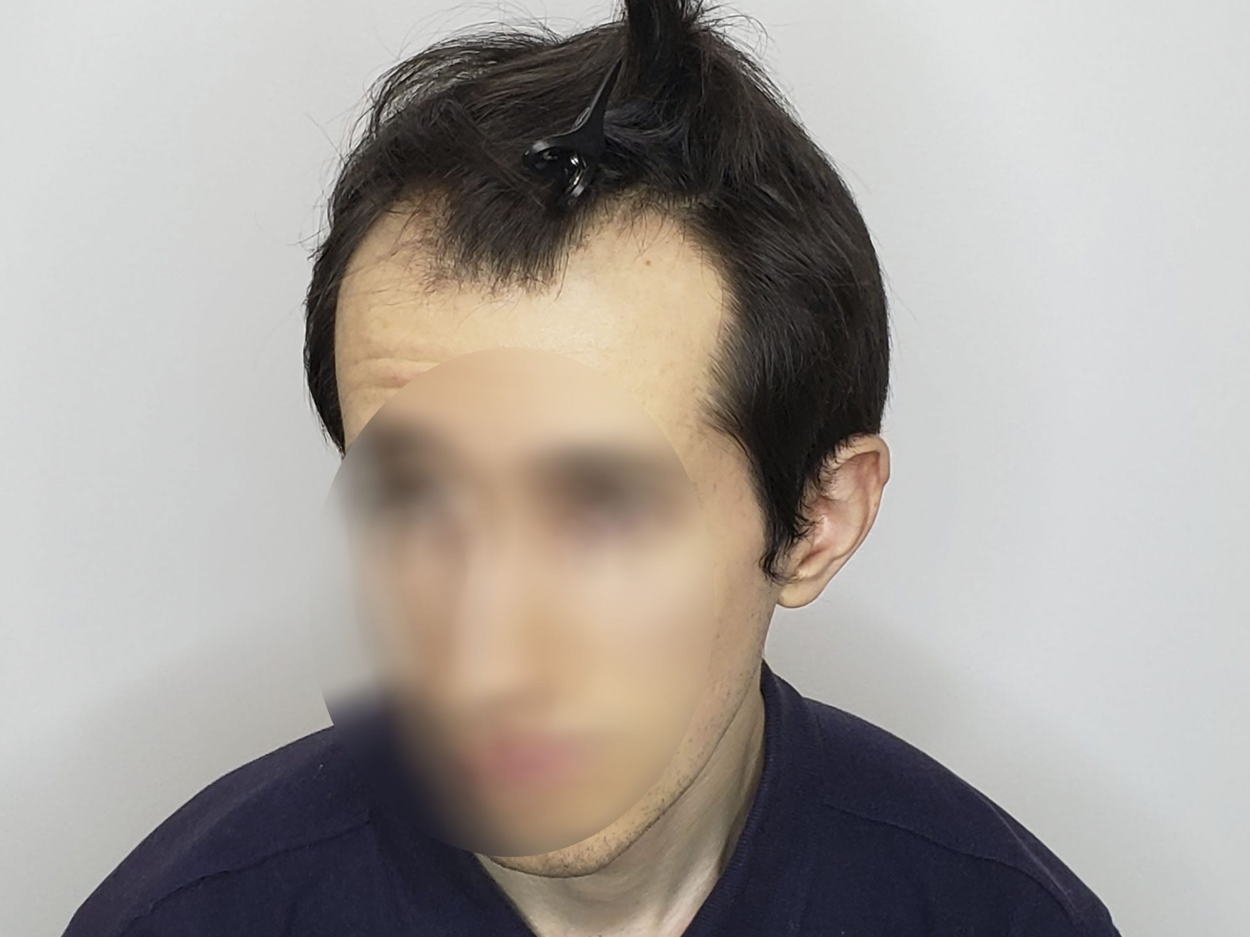 До