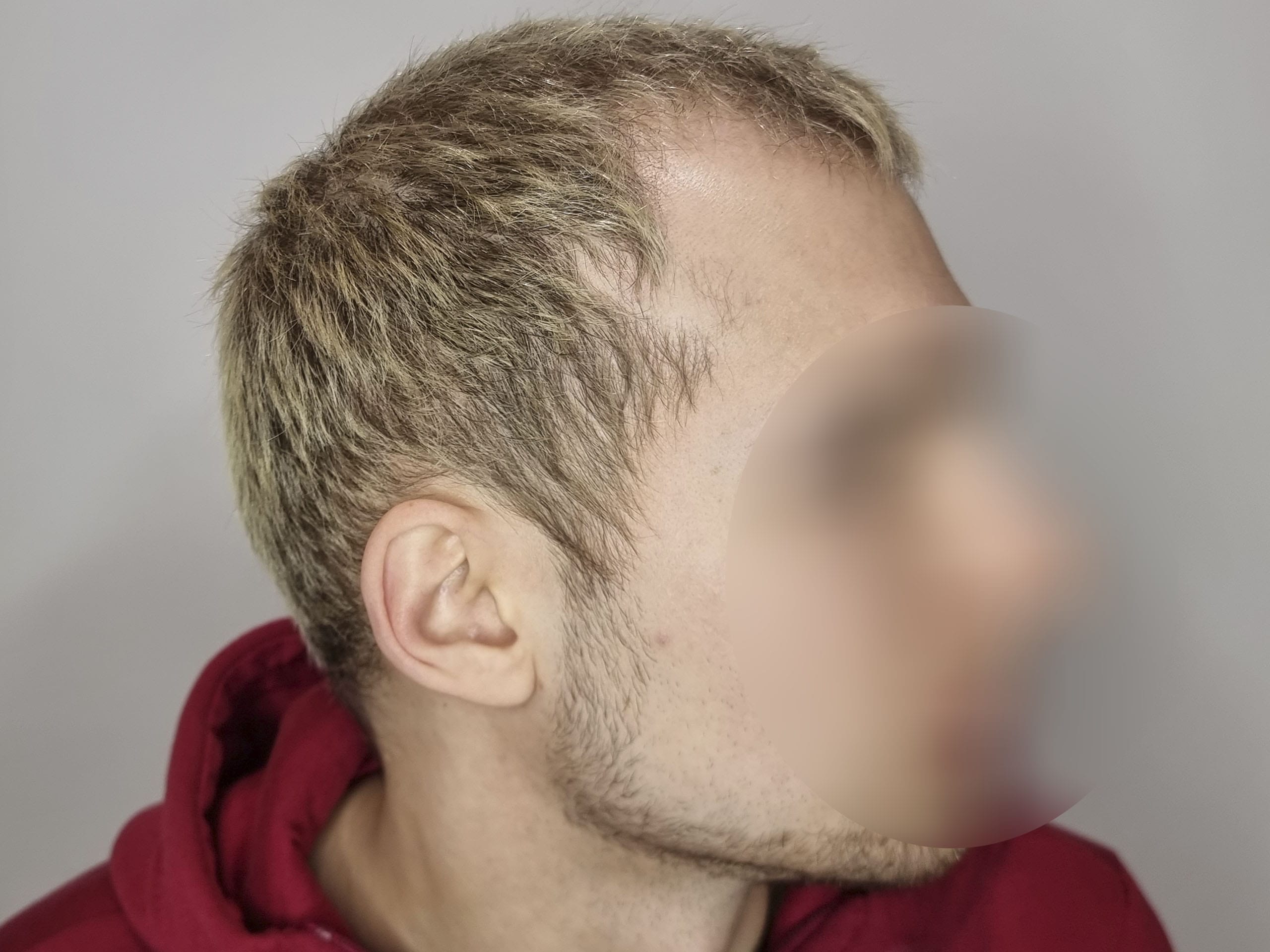 До