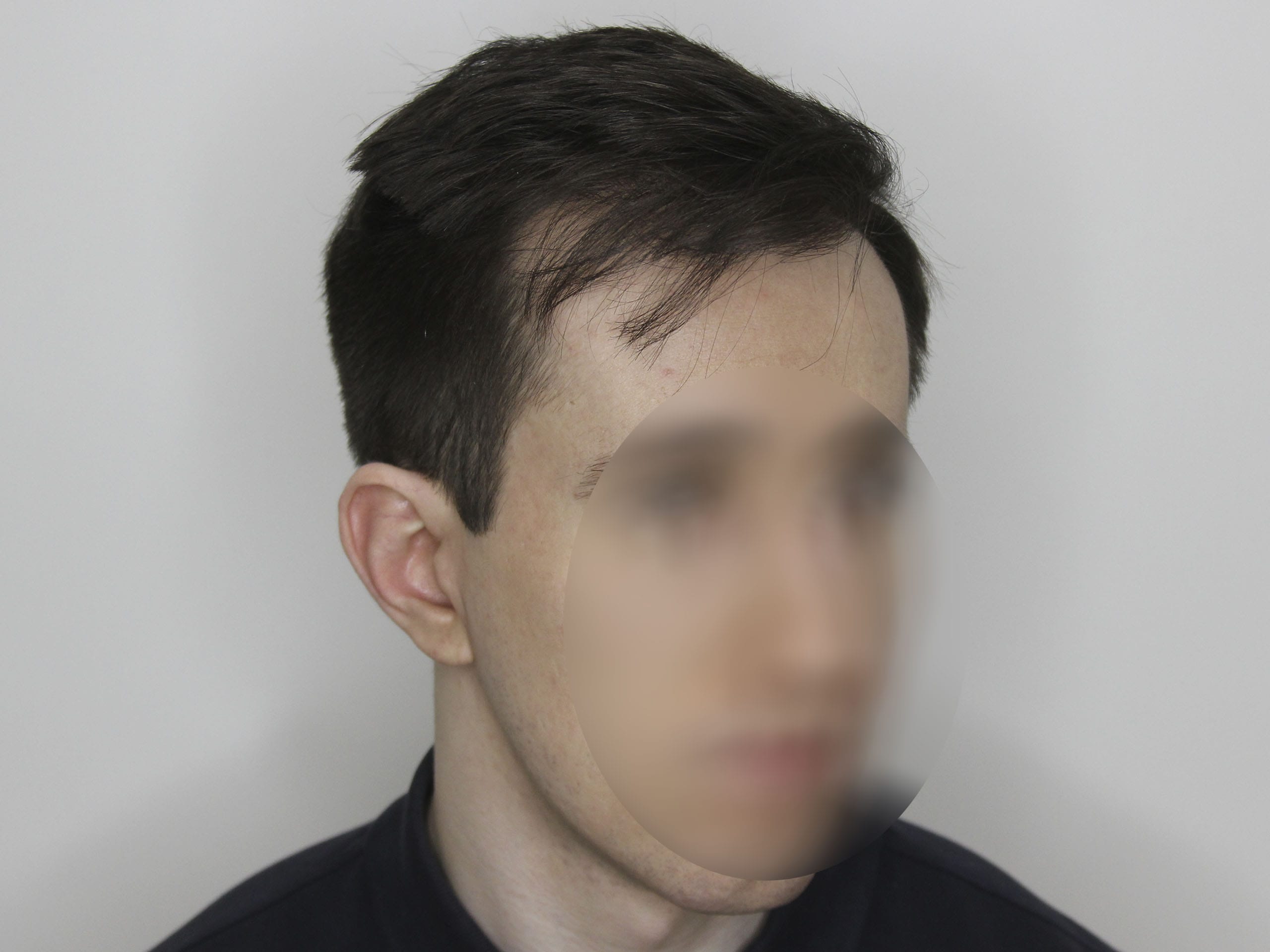 После