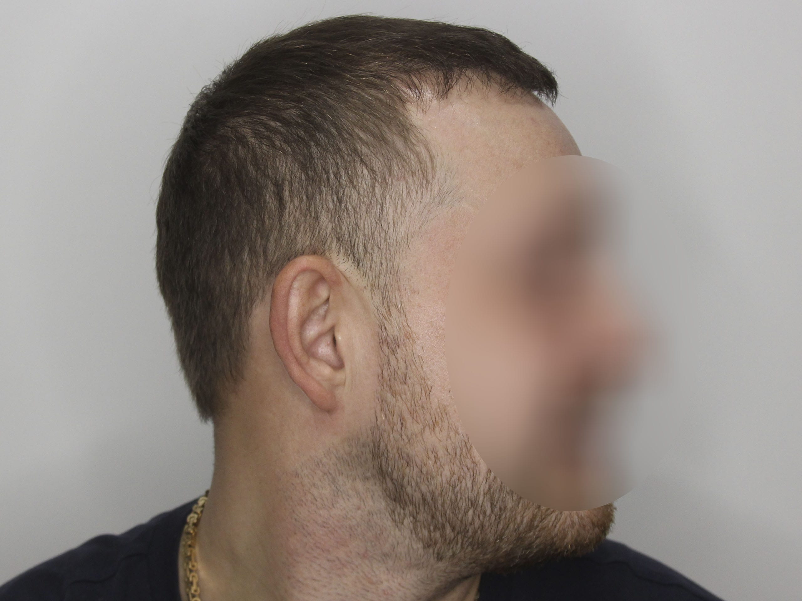 После