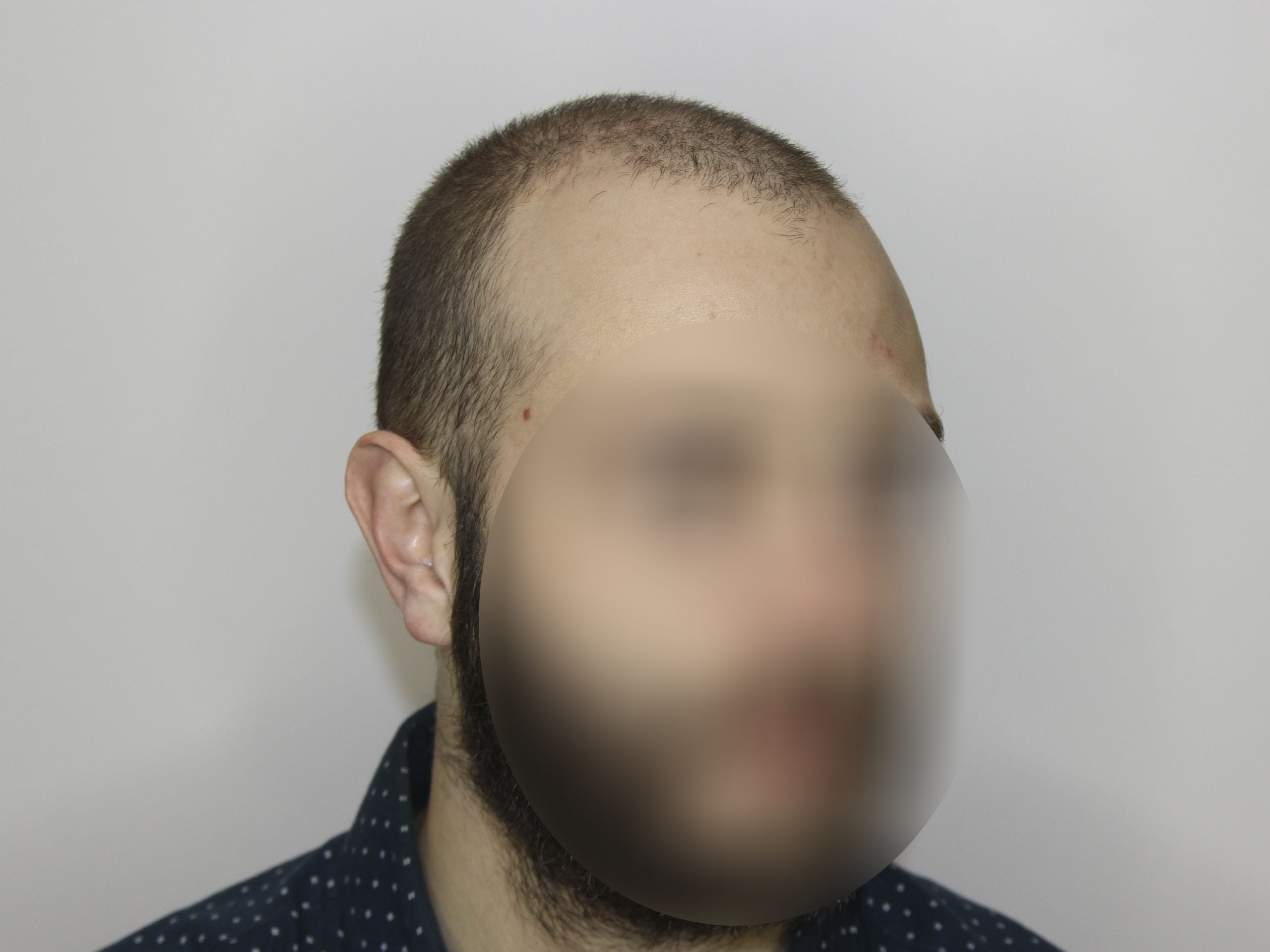 До
