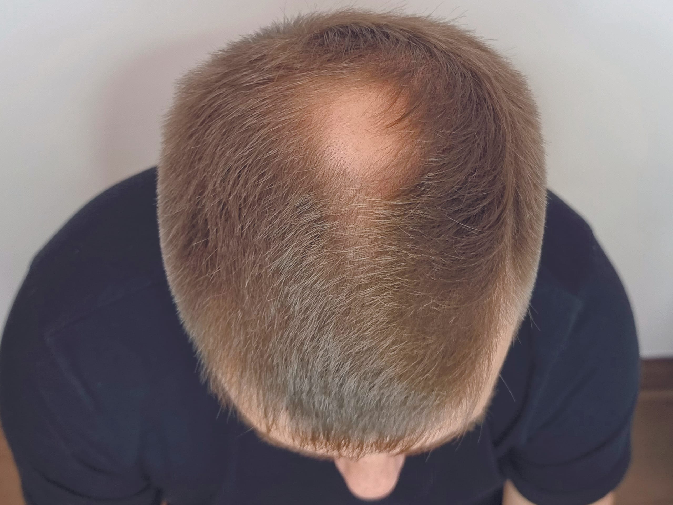 До