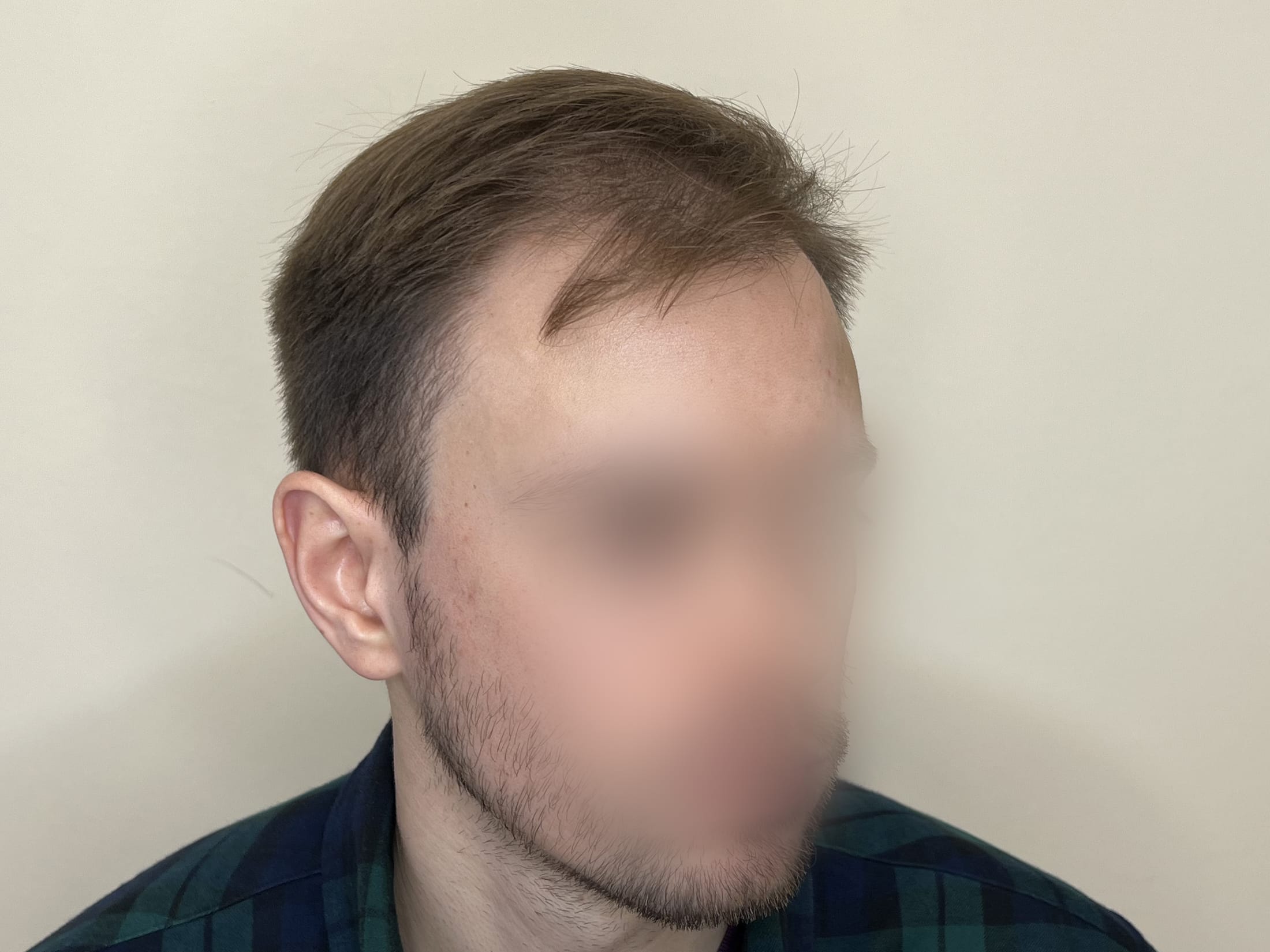 До