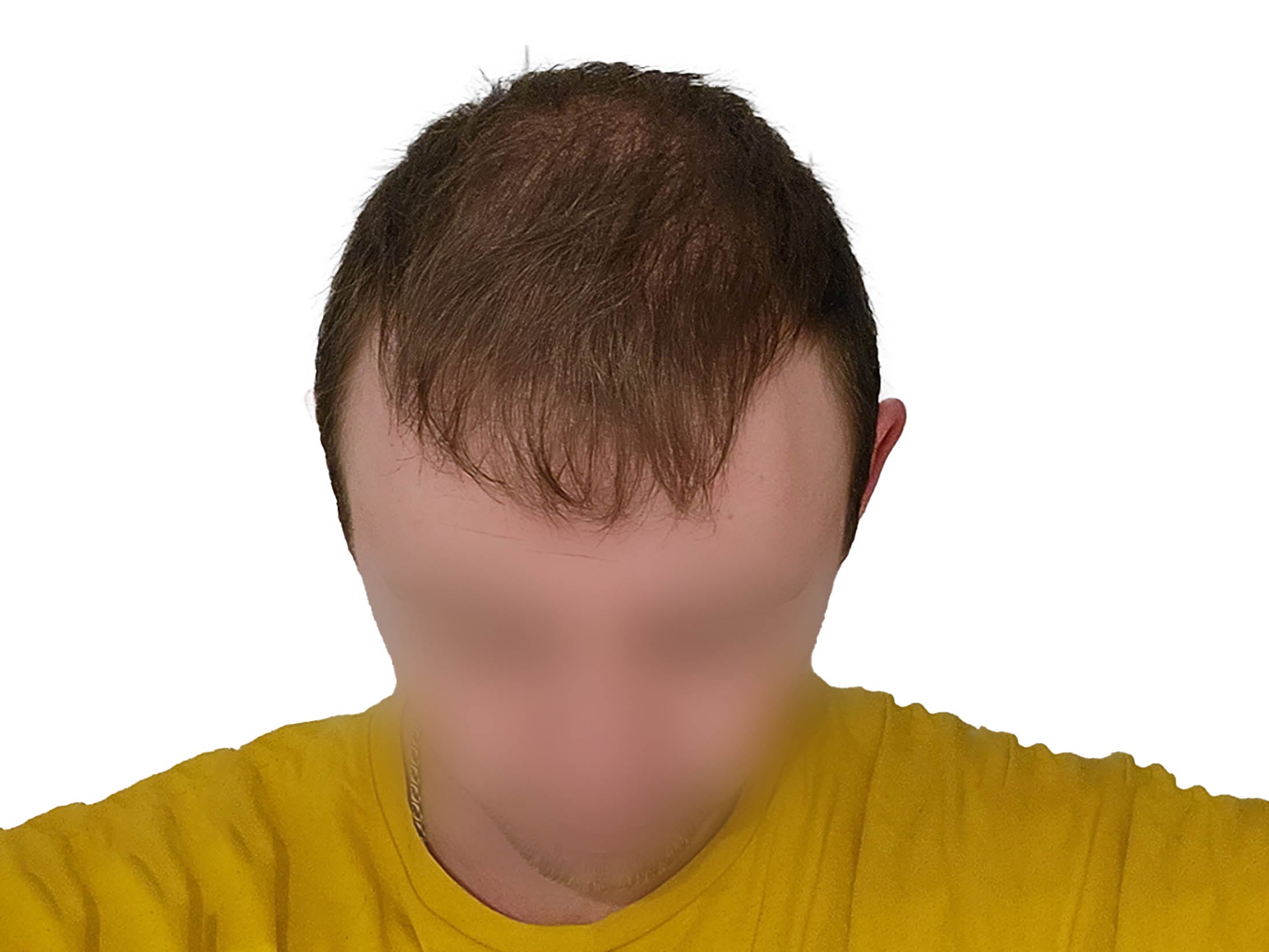 После