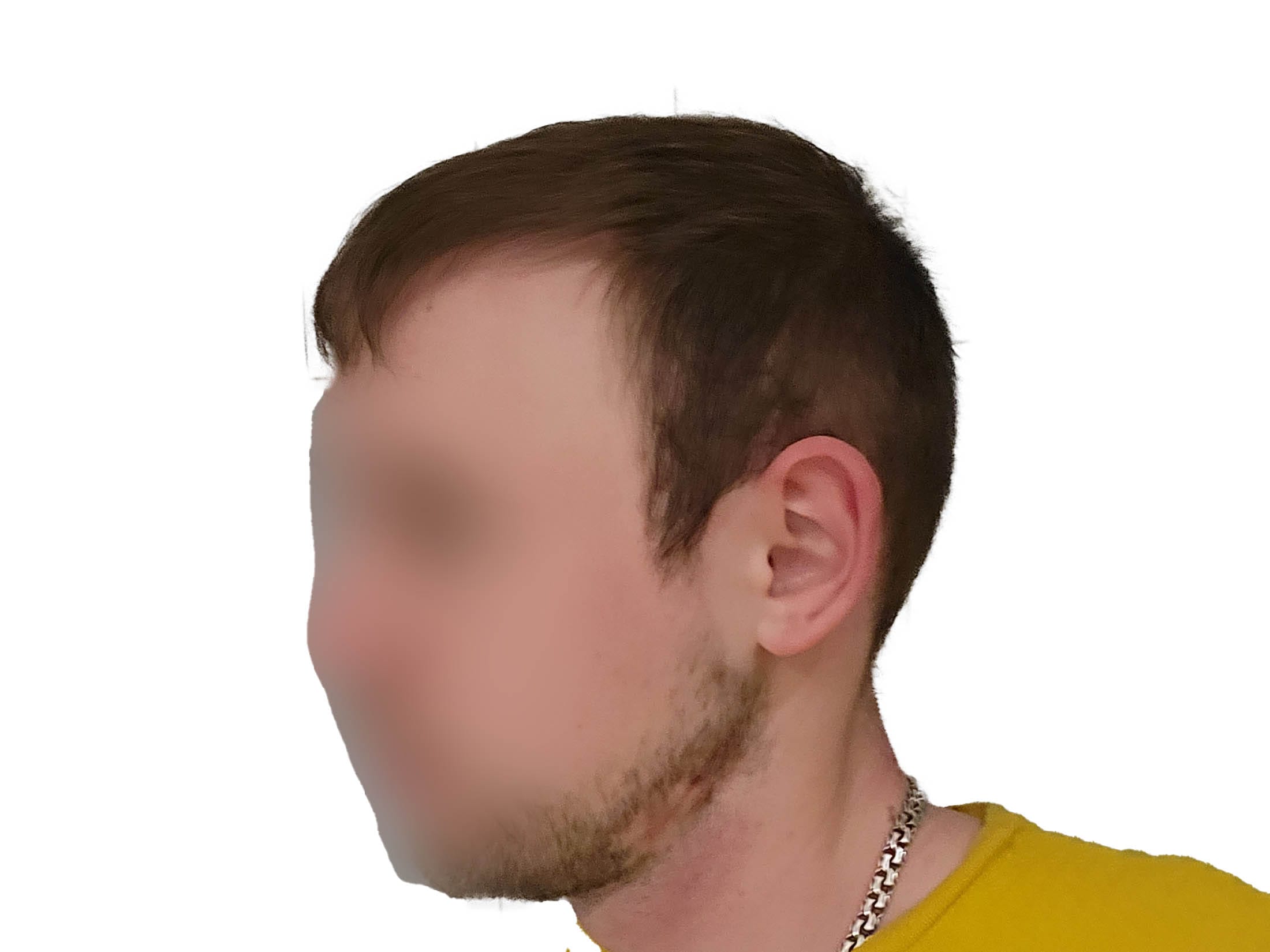 После
