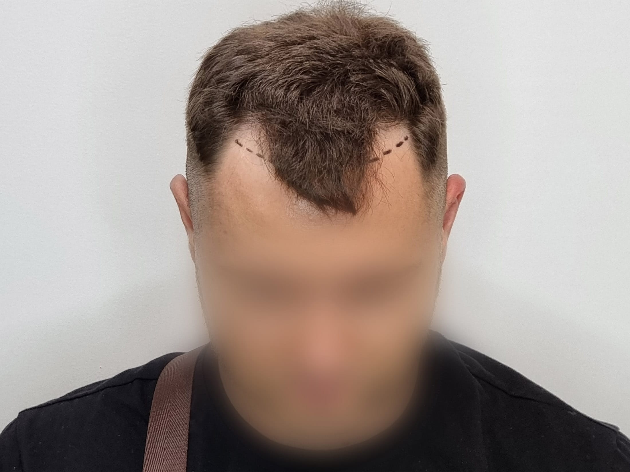 До