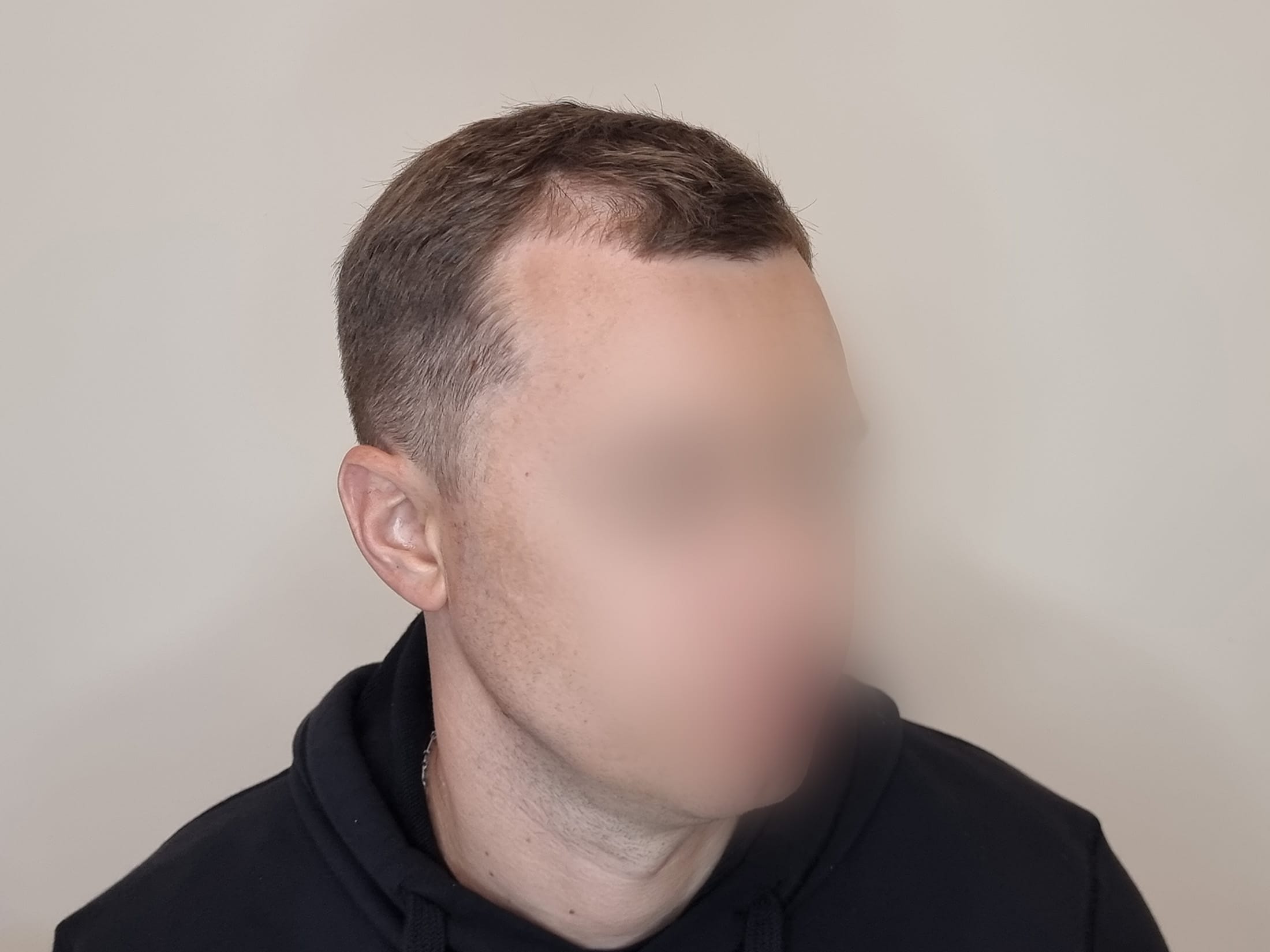 До