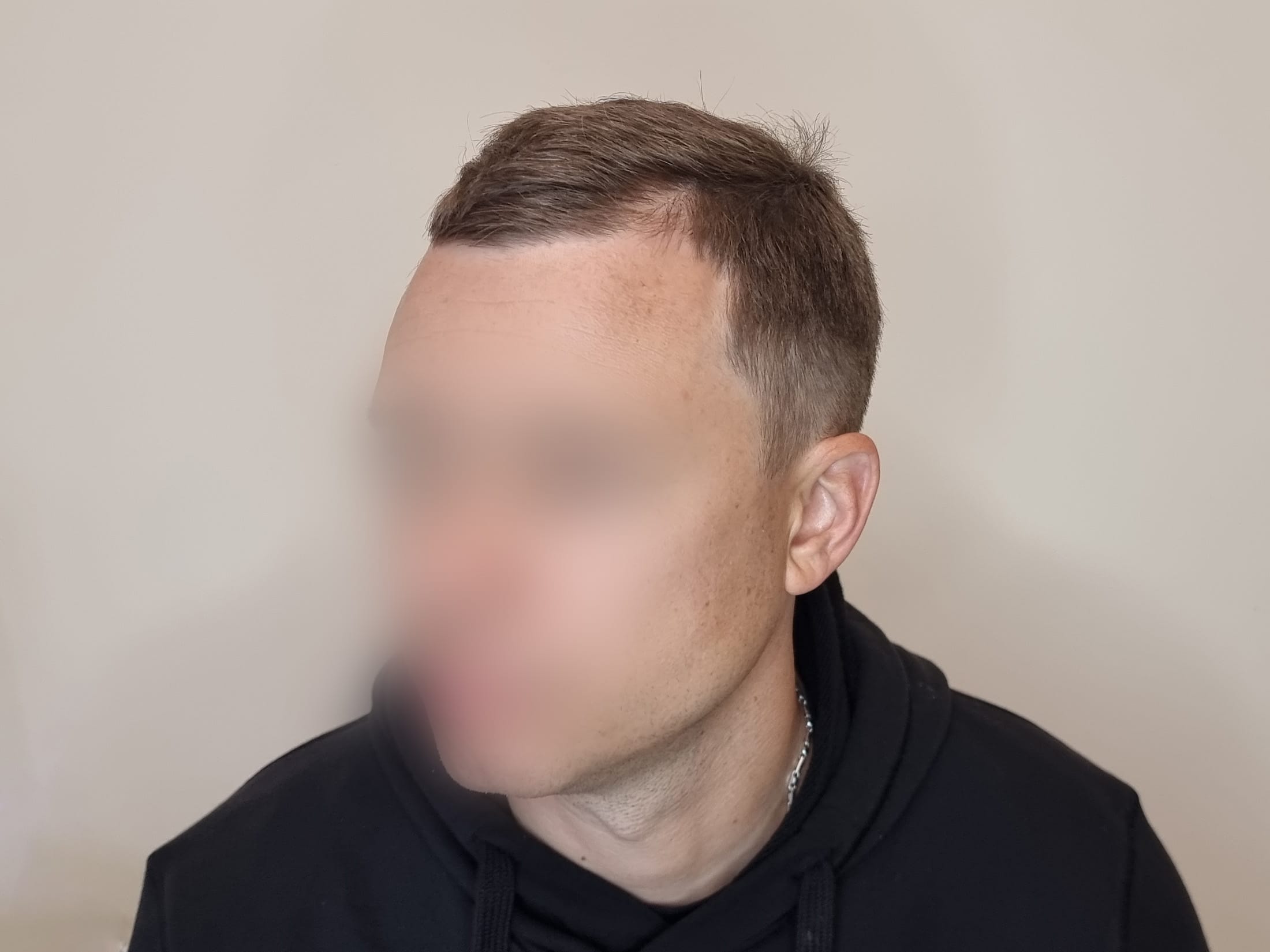 До