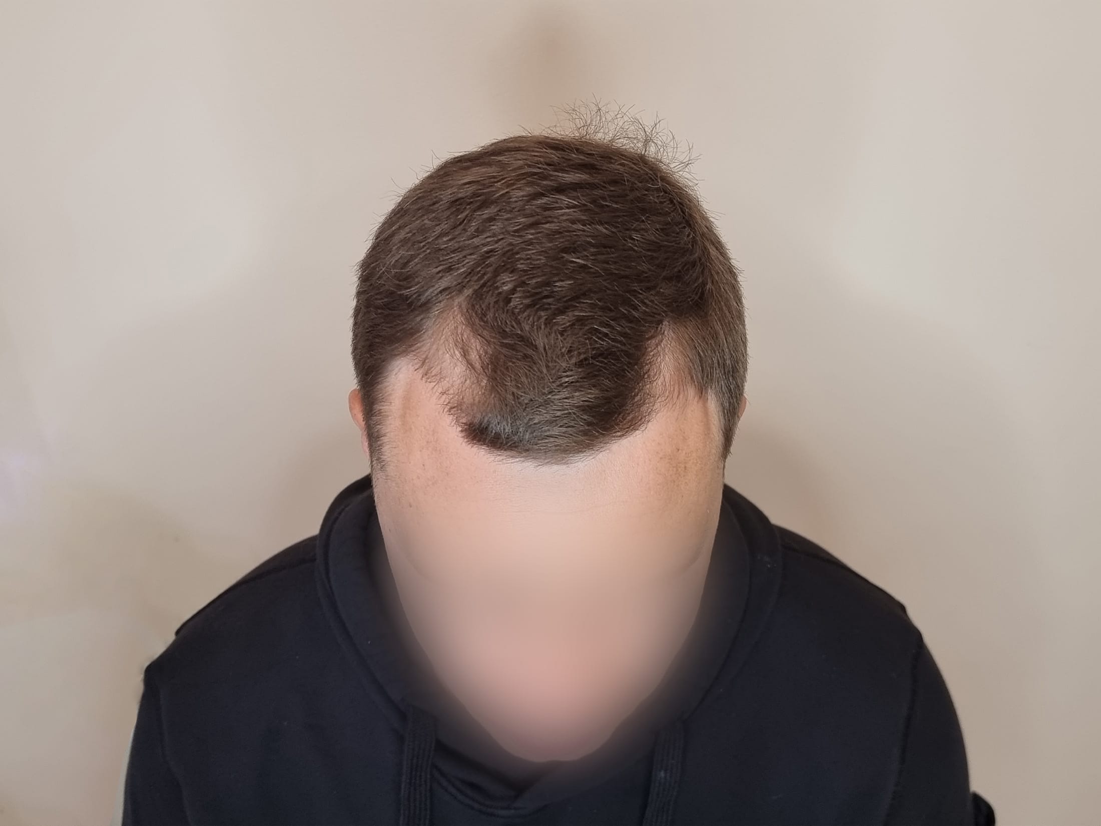 До