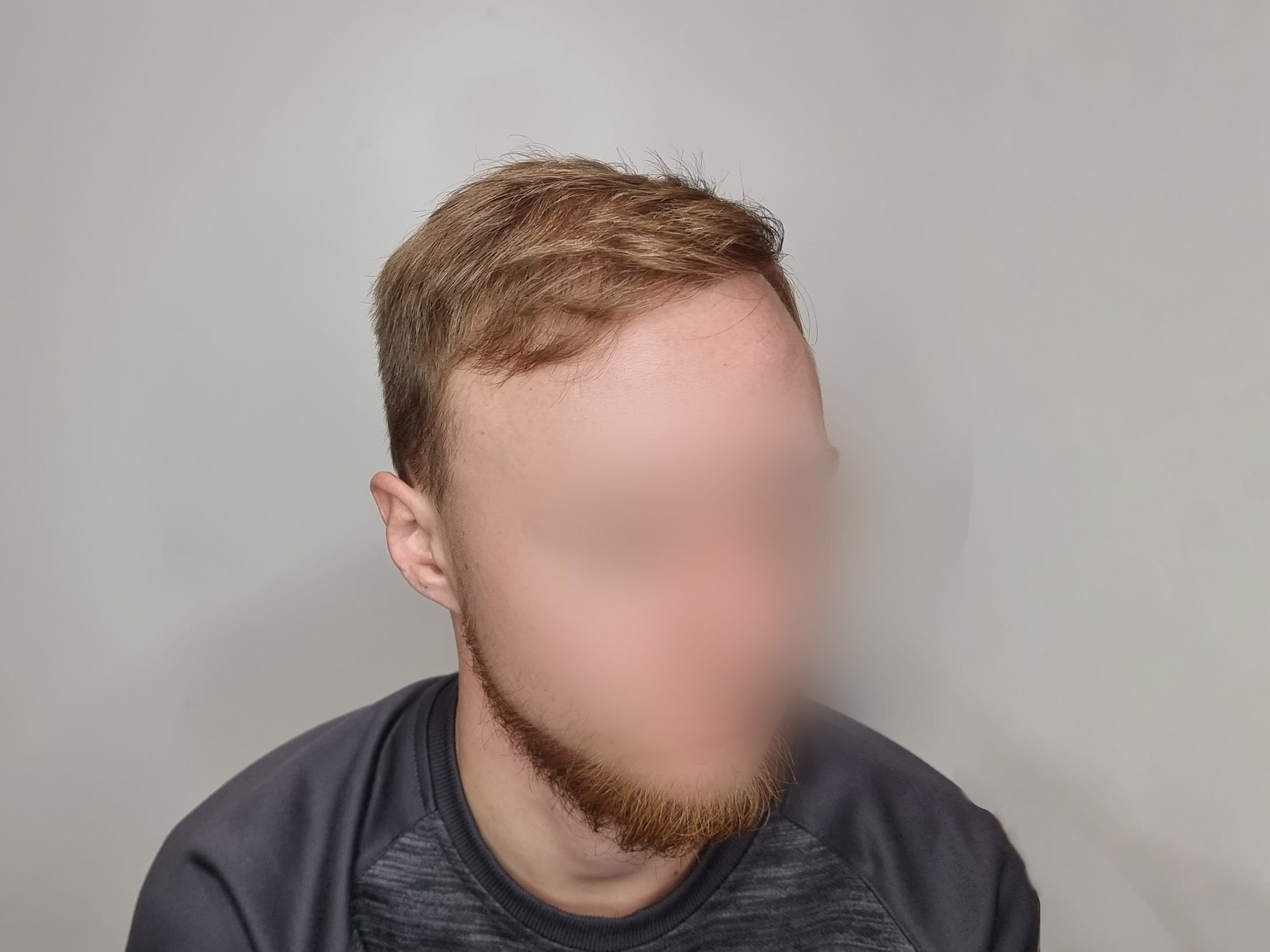 После