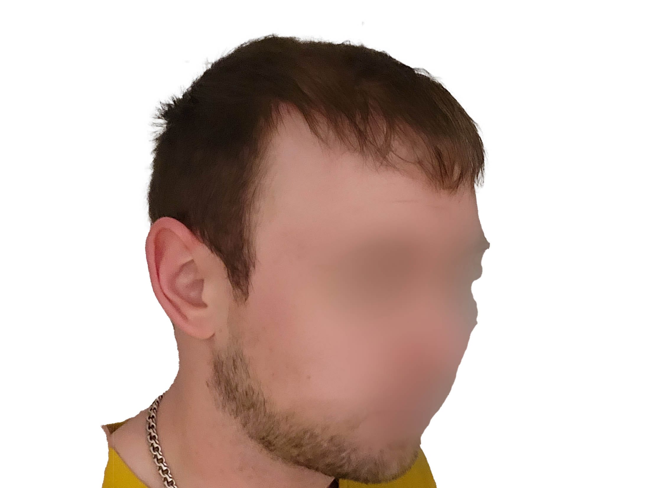 После