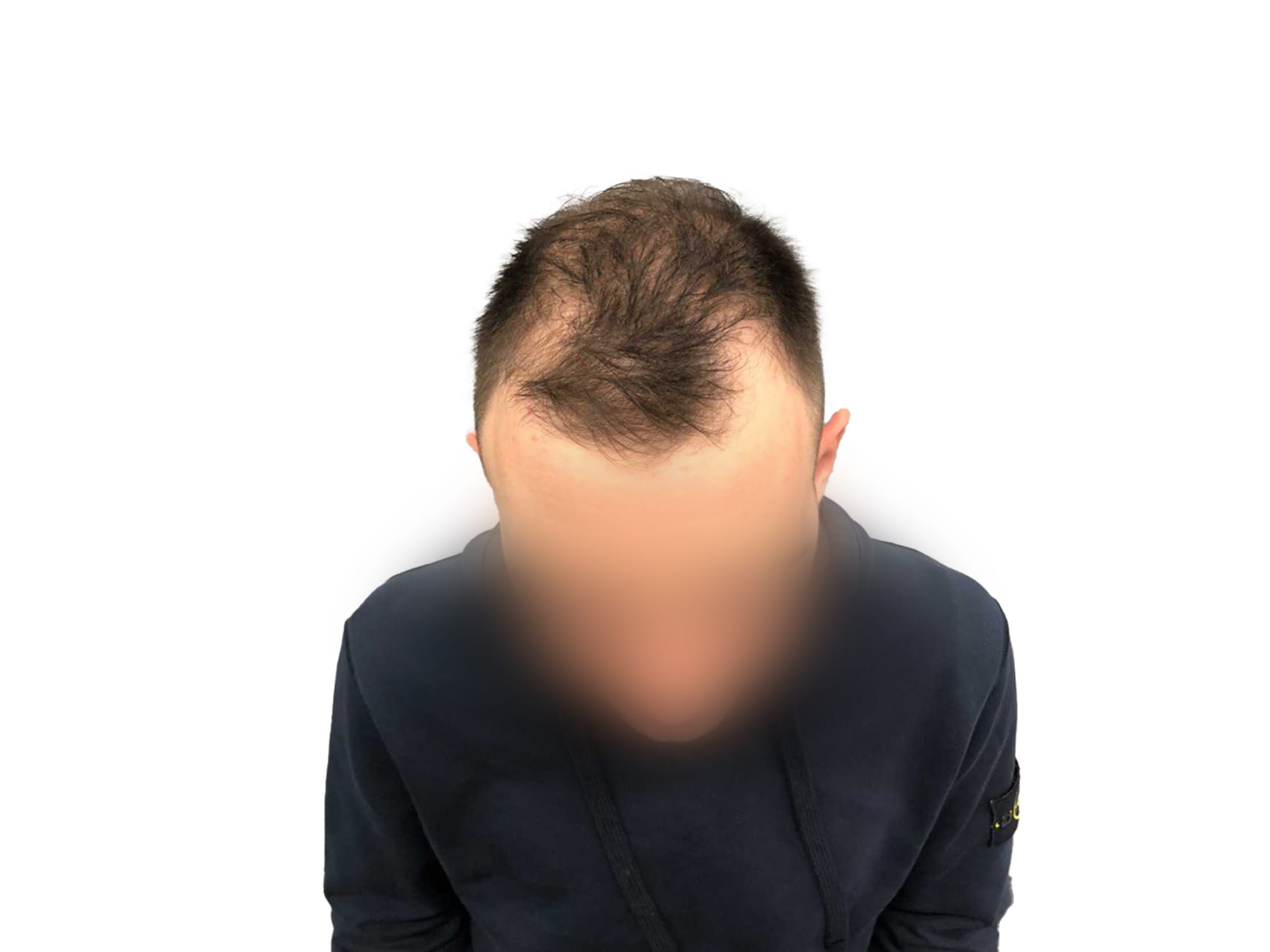 До