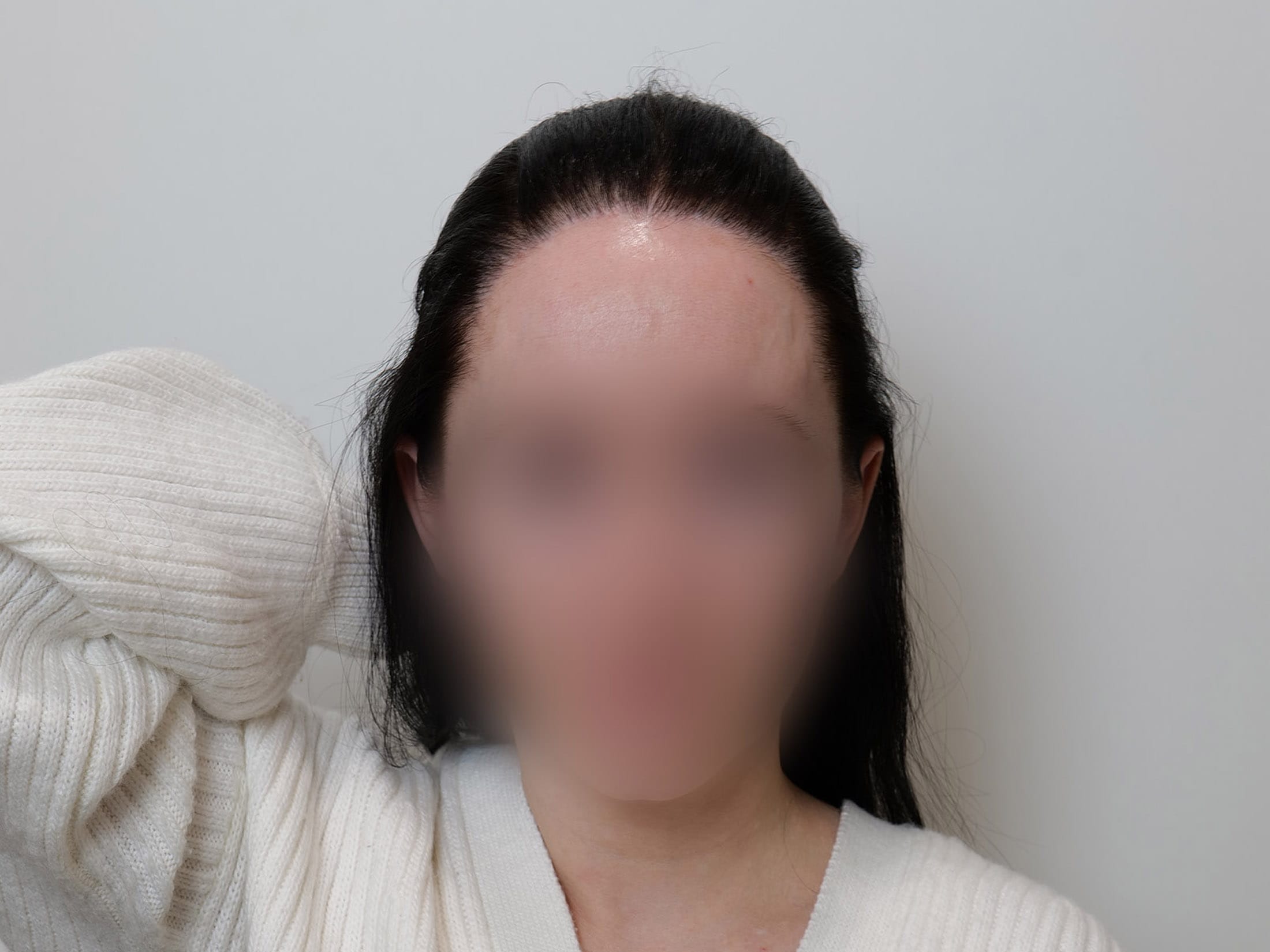 После